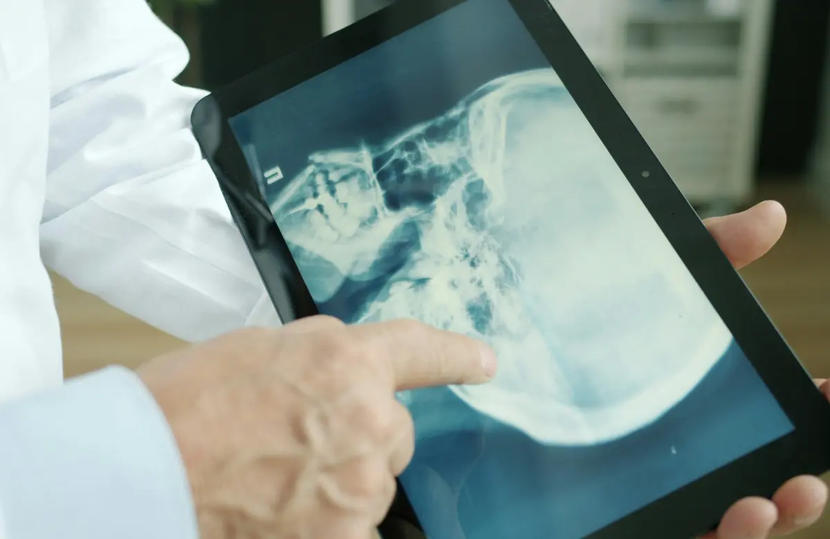 Profesional médico revisando una radiografía en una tableta